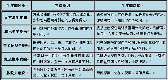 银屑病的危害不容忽视!